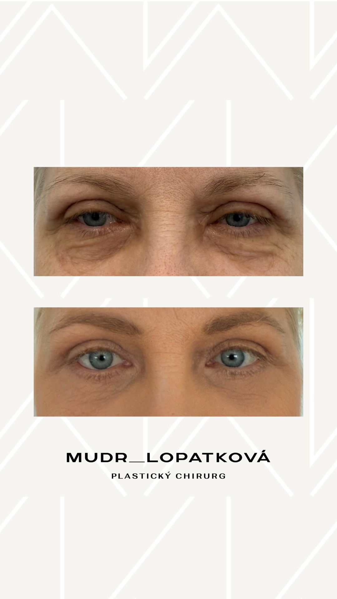 mudrlopatkova - ilustračná fotka časti tela